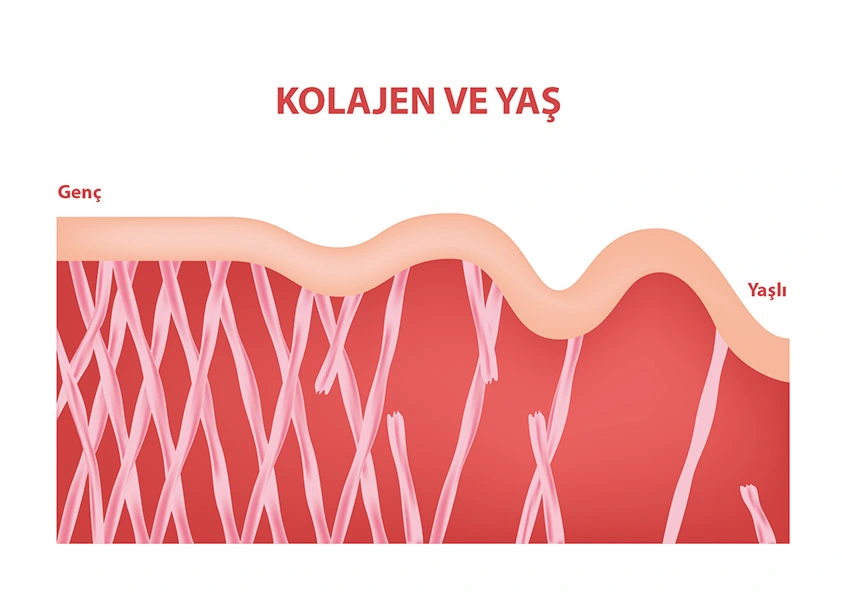 Kolajen Azalması Nedenleri Nelerdir?